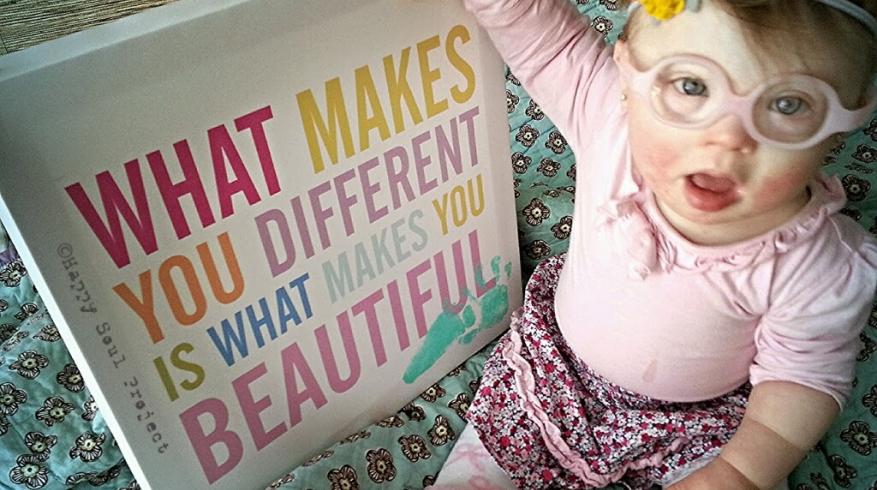 21 Μαρτίου - Παγκόσμια Ημέρα για το Σύνδρομο Down  